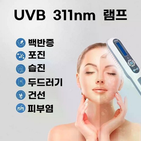백반증 건선 치료를 위한 311nm UVB 광선 요법 협대역 램프-추천-상품