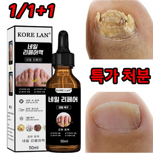 위틀스토어 - [뜨거운 판매]1/1+1 발톱무좀 네일 리페어 에센스 톱 발톱강화 손톱 발톱 무좀 케어 손톱진균 발톱무좀 큐티클 트리트먼트 에센스, 2개, 50ml