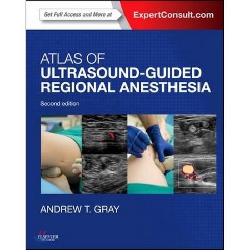 ultrasound TOP01