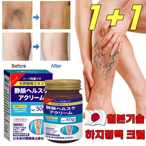 healmusz 하지정맥류 크림 - [일본 기술] 하지정맥 크림 하지정맥류 연고 다리부종 정맥염 혈관염 치료 크림, 2개, 50g