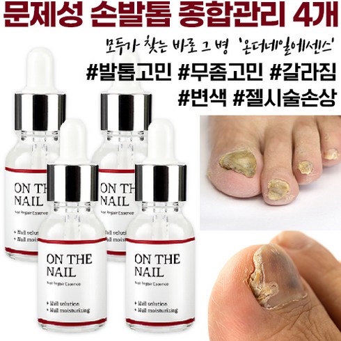 비비룩 온더네일 에센스, 15ml, 4개