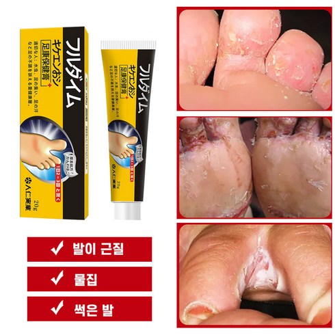 BT 발톱무좀 연고 무좀약 연고 발냄새 제거 발각질제거 연고, 1개, 20g