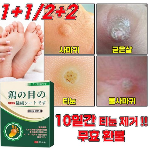 티눈제거밴드 - [당일 발출] 티눈제거 발바닥 통증 완화 티눈밴드 보호테이프 손가락 발가락 티눈뿌리 제거 패치, 2개