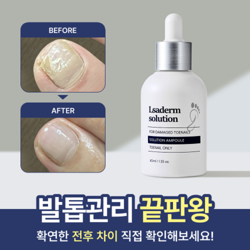 르사덤 - 르사덤 솔루션 추천 내성발톱 곰팡이 살균 발톱 40ml, 1개, 1개