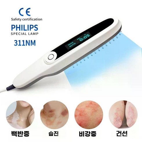 백반증 원인 건선 UVB 자외선 광선 요법 기구 치료 UV 311nm