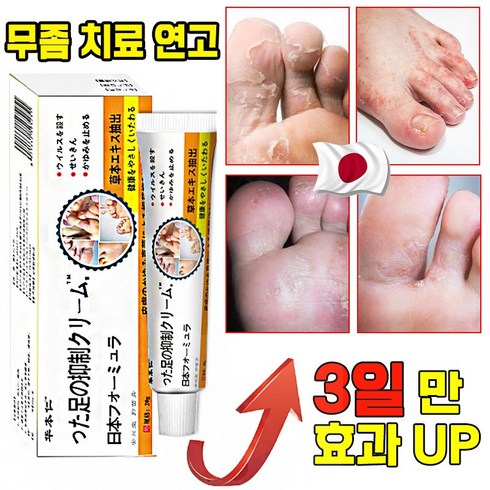 볼타렌연고 - [국내배송] 연고 발 가려움증 완화 연고 발냄새 제거 발각질 문제성발 제거 크림, 2개, 20g