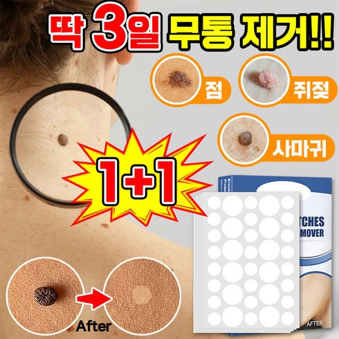 쥐젓제거연고 - [빠른배송] 피부 제거 패치 얼굴 바디 피부 치료 라벨 스텔스 포장증정, 143매입, 2개