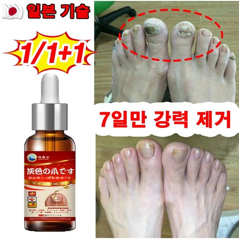 라셀턴 - [효과보장] 일본 1/1+1 손톱 발톱 무좀 영양제 앰플 네일 케어 에센스 문제성 손 발톱 관리, 1개, 30ml