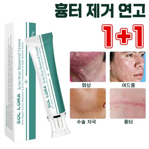 [1+1특가] 흉터 제거 연고 재생 크림 화상 수술 상처 치료 재생연고 사은품증성, 30ml, 2개