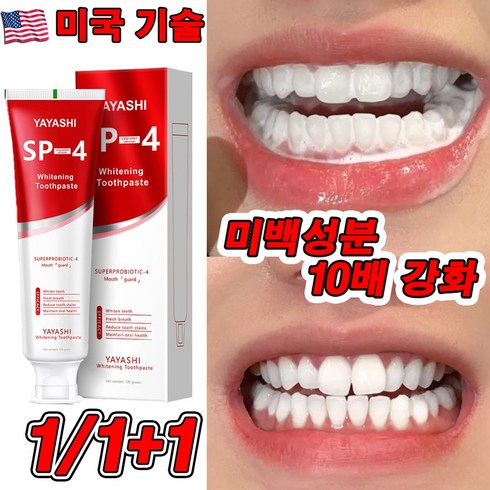 락토케어치약 - 미국 SP4 1+1/2+2 고불소 미백 치약 프로바이오틱 치약 화이트닝 잇몸붓기 염증 예방 구취케어 치약, 1개, 120g