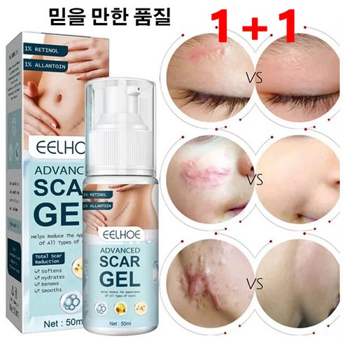 1+1흉터 제거 연고 50ml 흉터 개선 젤 오래된흉터제거연고 상처흉터연고 쌍꺼풀 흉터/제왕절개 흉터/수술 흉터 여드름 흉터/비후형 흉터/화상 흉터, 50ml*4+50ml*4