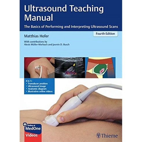 ultrasound TOP01