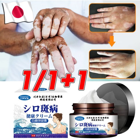 일본 1+1/2+2 백반증 연고 반점제거 손 목 얼굴 백반증치료, 3+3