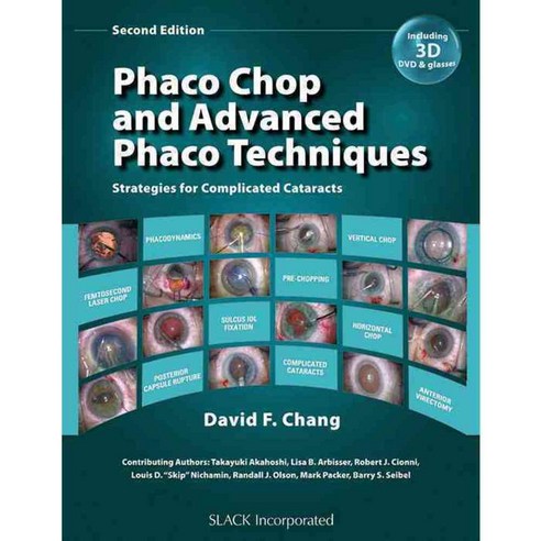 Phaco Chop and Advanced Phaco Techniques: Strategies for Complicated Cataracts, Slack Inc