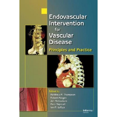 Endovascular Intervention for Vascular Disease: Principles and Practice Hardcover, Informa Medical