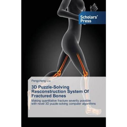 3D Puzzle-Solving Resconstruction System of Fractured Bones Paperback, Scholars'' Press