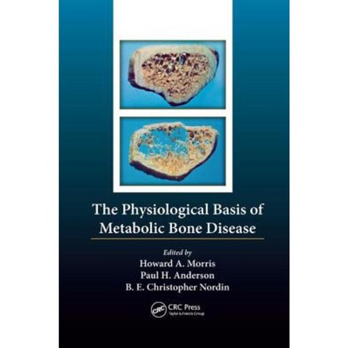 The Physiological Basis of Metabolic Bone Disease Paperback, CRC Press