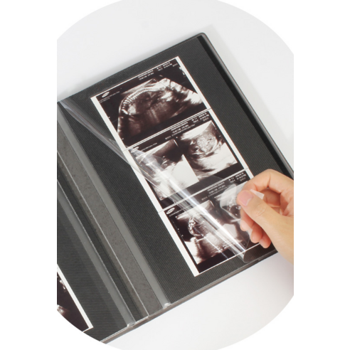 소중한 첫 만남, 리코즈 베베 초음파 앨범으로 영원히 간직하세요.