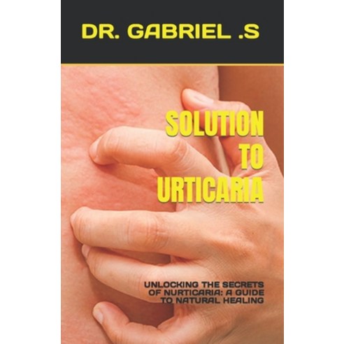 (영문도서) Solution to Urticaria: Unlocking the Secrets of Nurticaria: A Guide to Natural Healing Paperback, Independently Published, English, 9798399380377