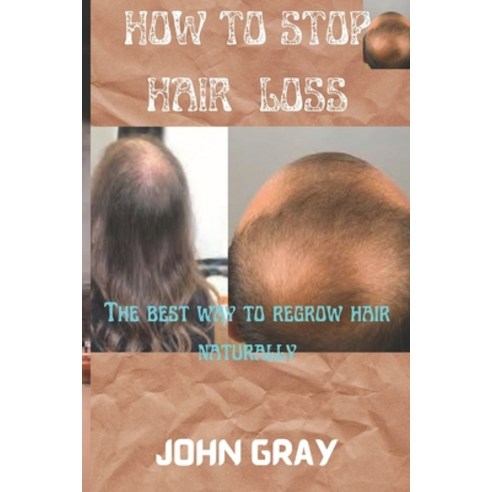 (영문도서) How to stop hair loss: The best way to regrow hair naturally Paperback, Independently Published, English, 9798849293011