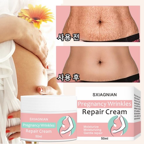 (한국셀러/본토출하)임산부 산전후 튼살 탄력케어 크림 흉터관리 임산부 청소년 이용가능, 1개, 50g