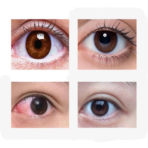 지친 눈에 생기를, 섬세한 눈 건강 솔루션