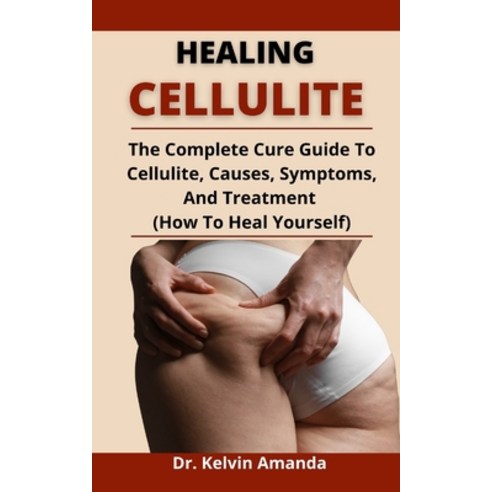 (영문도서) Healing Cellulite: The Complete Cure Guide To Cellulite Causes Symptoms And Treatment (How ... Paperback, Independently Published, English, 9798525768659