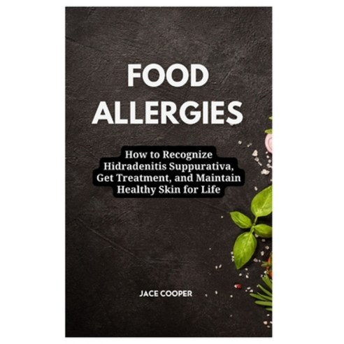 (영문도서) Food Allergies: How to Eat Well with Food Allergies: A Comprehensive Guide to Diagnosis Trea... Paperback, Independently Published, English, 9798877793880