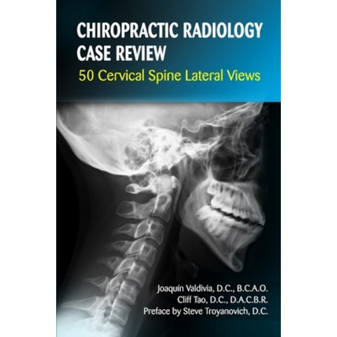 Chiropractic Radiology Case Review: 50 Cervical Spine Lateral Views Paperback, Independently Published