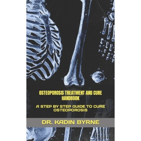 (영문도서) Osteoporosis Treatment and Cure Handbook: A Step by Step Guide to Cure Osteoporosis Paperback, Independently Published, English, 9798354999873