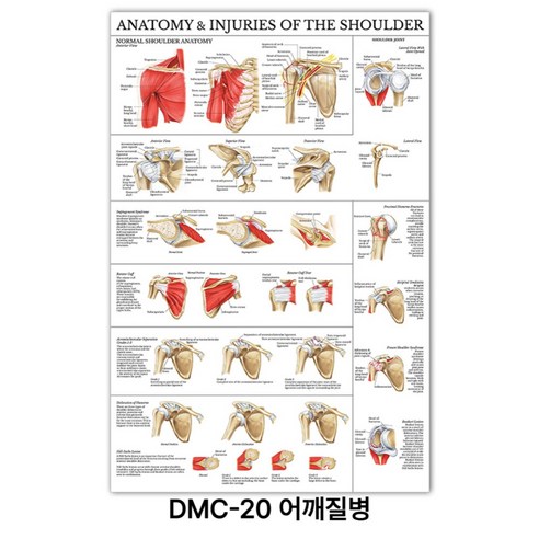 NEW 근육 해부학 포스터, DMC-20 어깨질병