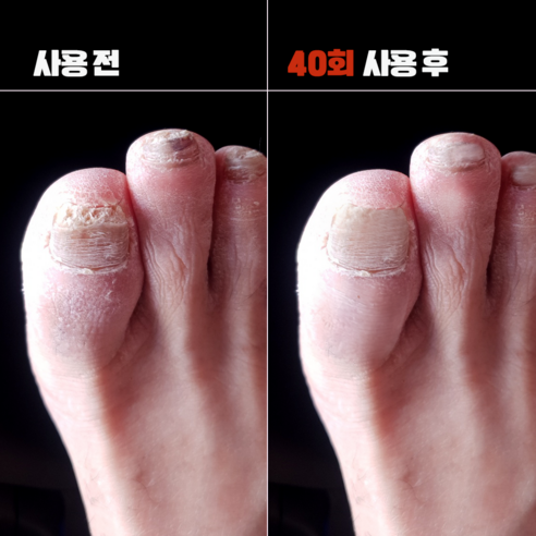 칙 뿌리는 유산균, 피부 장벽부터 촉촉함까지!