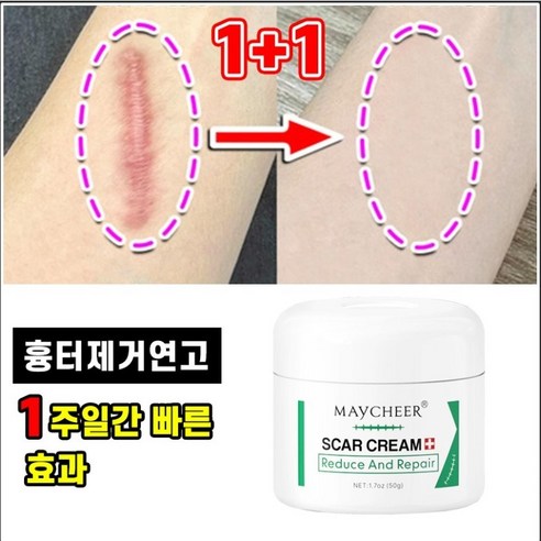 [빠른배송] 1+1 흉터 제거 연고 수술 상처 화상 피부 흉터 크림 제왕절개 흉터 관리 포장증정, 3개, 30g