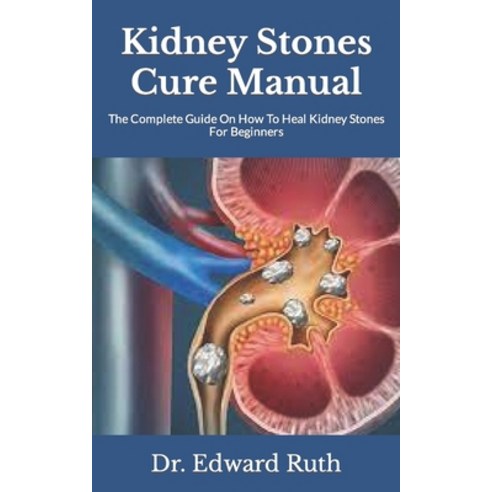 (영문도서) Kidney Stones Cure Manual: The Complete Guide On How To Heal Kidney Stones For Beginners Paperback, Independently Published, English, 9798498227764