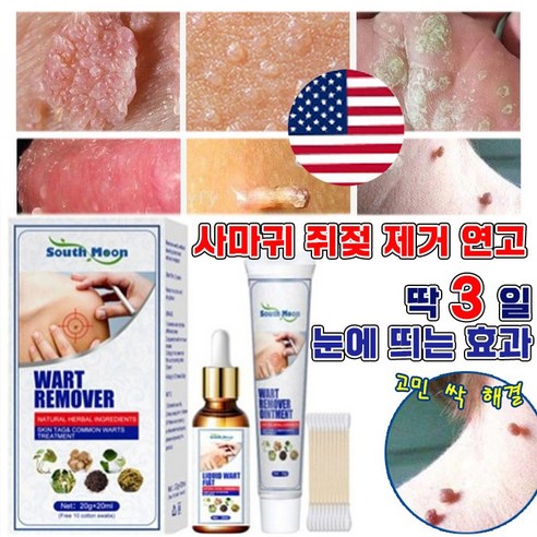 [국내배송] 제거제 얼굴 기미 제거 연고 점빼기 피부 치료 연고, 4개, 30g