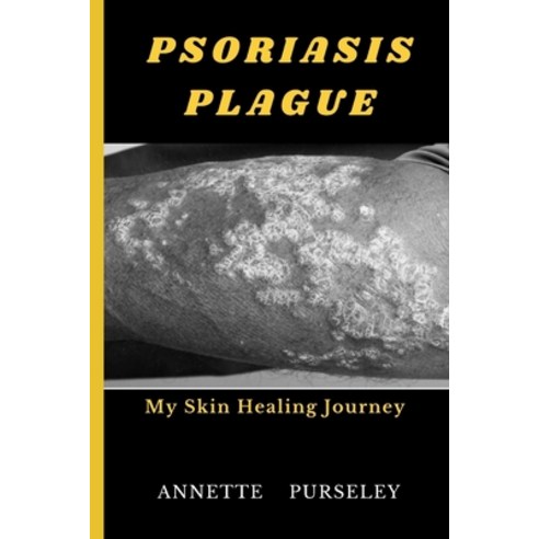 (영문도서) Psoriasis Plague: My Skin Healing Journey Paperback, Independently Published, English, 9798375611068