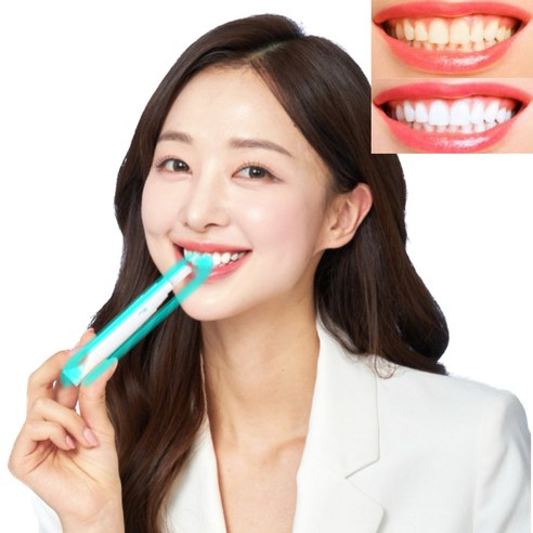 치과미백동일 셀프 치아미백제의 효과와 가격에 대해 알아보자!