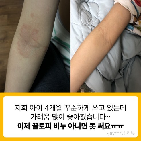 자연의 힘으로 민감한 피부를 다독이는 꿀토피 플라보노이드 수제 비누