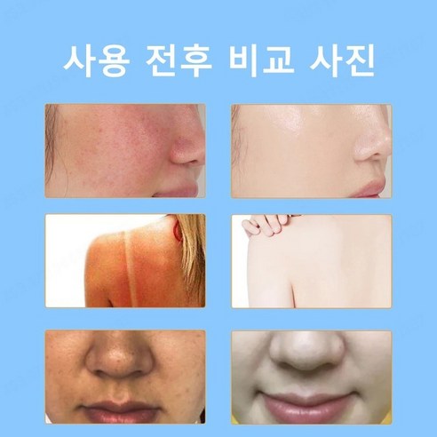 독일 기술로 UV 보호, 민감한 피부도 안심