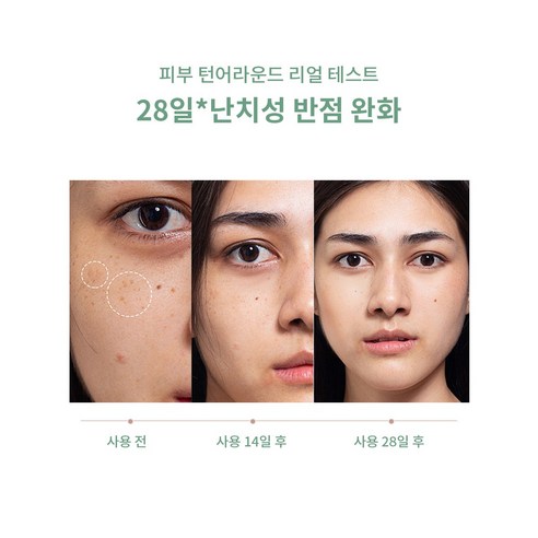대용량 미 잡티 패치: 잡티와 기미를 줄이고 빛나는 피부로 변신하세요!