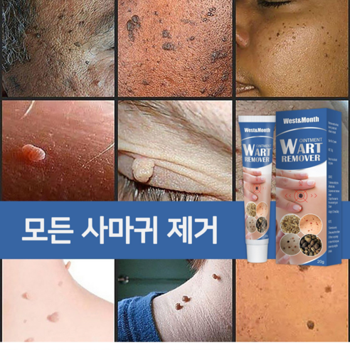 [미국수입원]제거율 99.99 세이프티 포뮬러쾌속적 유효비립종제거|편평사마귀|얼굴사마귀|사상사마귀LK020, 2개, 20g