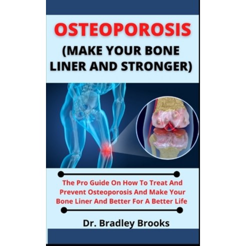 (영문도서) Osteoporosis (Make Your Bone Stronger): The Pro Guide On How To Treat And Prevent Osteoporosi... Paperback, Independently Published, English, 9798537698647