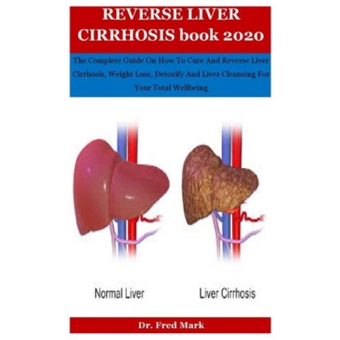 Reverse Liver Cirrhosis Book 2020: The Complete Guide On How To Cure And Reverse Liver Cirrhosis We... Paperback, Independently Published, English, 9798577843816