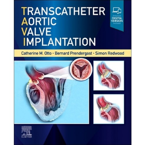 (영문도서) Transcatheter Aortic Valve Implantation Hardcover, Elsevier, English, 9780323757928