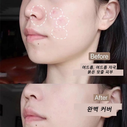 SILIYOUNG 강력 컨실러: 감쪽같은 커버로 되찾는 피부 자신감