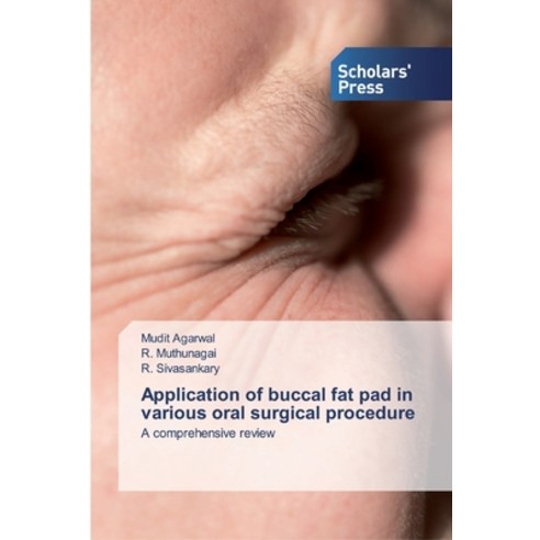 Application of buccal fat pad in various oral surgical procedure Paperback, Scholars'' Press