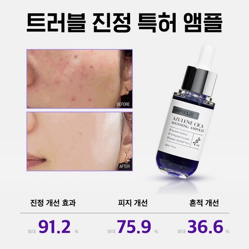 임피엘 아줄렌 시카 앰플로 민감한 피부, 이제 편안하게!
