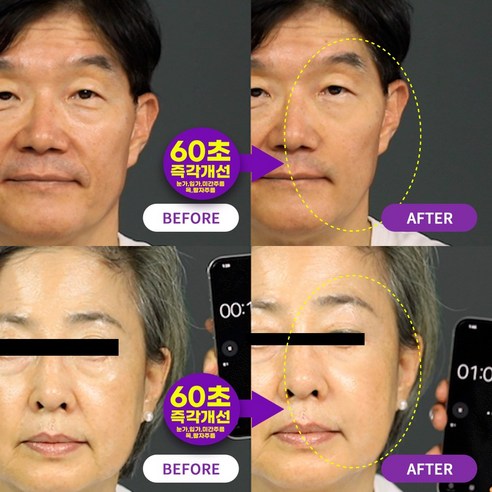 코스셀 레티놀 볼륨 아이백 크림으로 눈가에 피어나는 젊음을 되찾으세요.