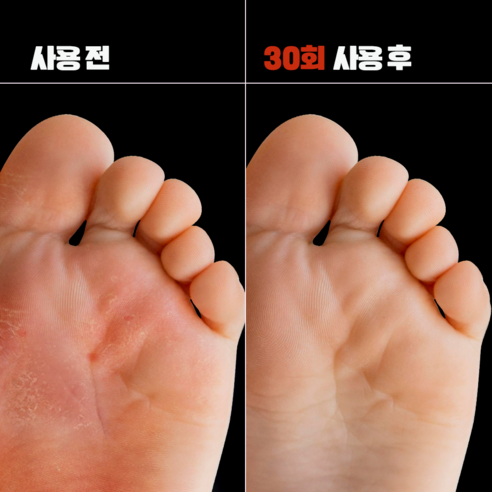 칙 뿌리는 유산균, 피부 장벽부터 촉촉함까지!