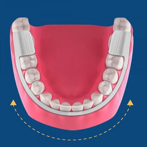 이갈이 방지용 마우스 피스 치아 손상 방지 보호대 윗니 아랫니 착용, 1개 이갈이마우스피스24,500원